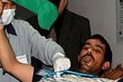 Раненые ливийцы поправляют здоровье в Турции. // nationalturk.com